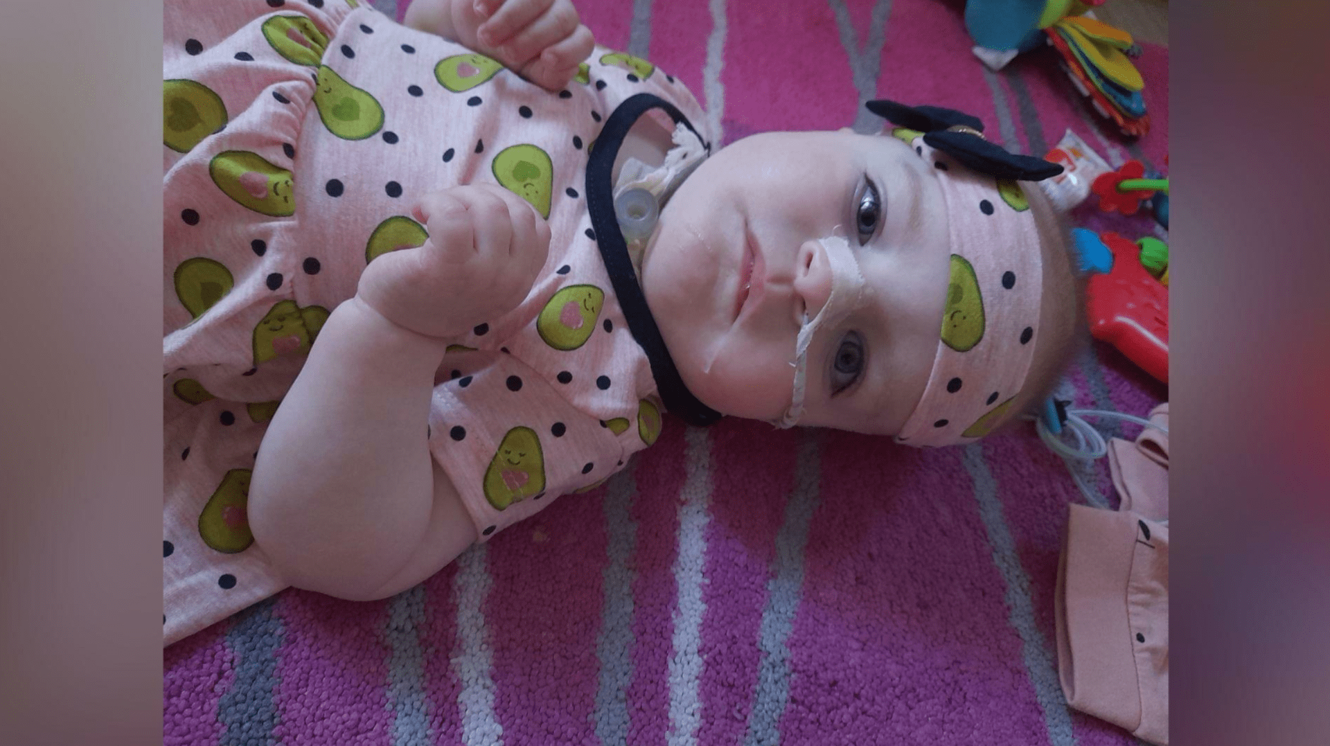 Dvouletá Dianka se narodila se vzácným syndromem.