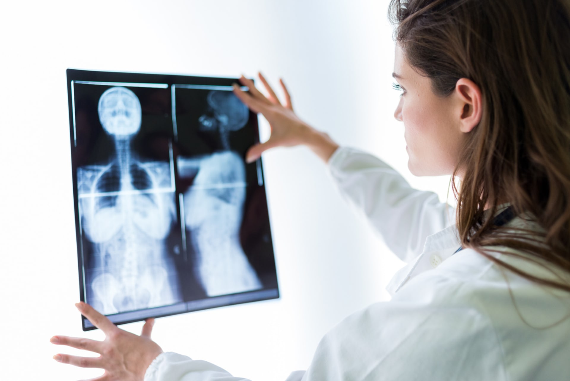 Hustá prsní tkáň může zhoršit čitelnost rentgenového snímku 