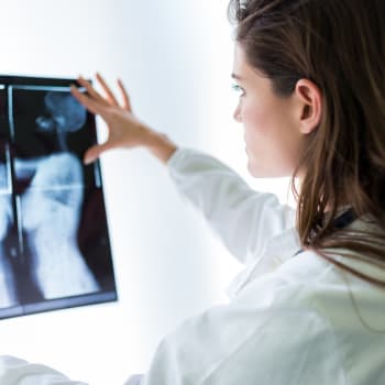 Hustá prsní tkáň může zhoršit čitelnost rentgenového snímku 