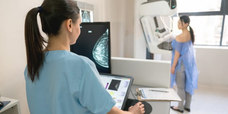 Preventivní mamografický screening 