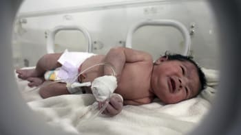 Zázračné dítě zachráněné ze sutin v Sýrii už má jméno. Lékař prozradil, jak na tom je