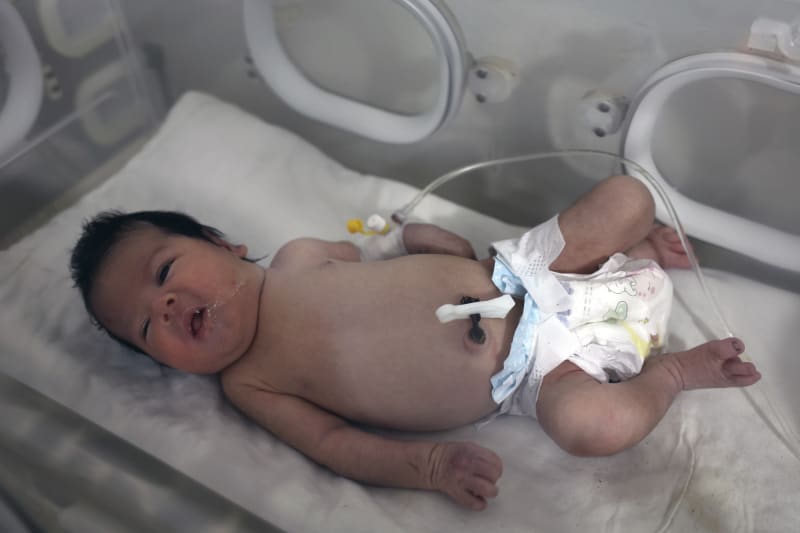 Holčička, která se narodila pod troskami po zemětřesení, jež zasáhlo Sýrii a Turecko, je ošetřována v inkubátoru v dětské nemocnici ve městě Afrín v syrské provincii Aleppo ve čtvrtek 9. února 2023. 