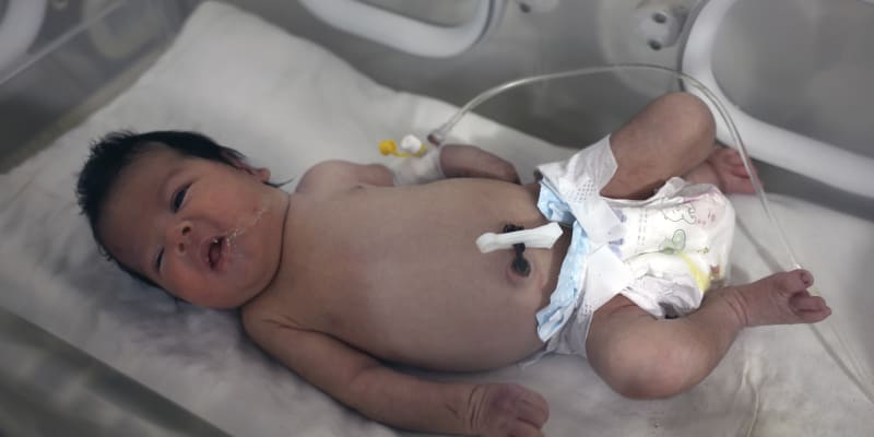 Holčička, která se narodila pod troskami po zemětřesení, jež zasáhlo Sýrii a Turecko, je ošetřována v inkubátoru v dětské nemocnici ve městě Afrín v syrské provincii Aleppo ve čtvrtek 9. února 2023. 