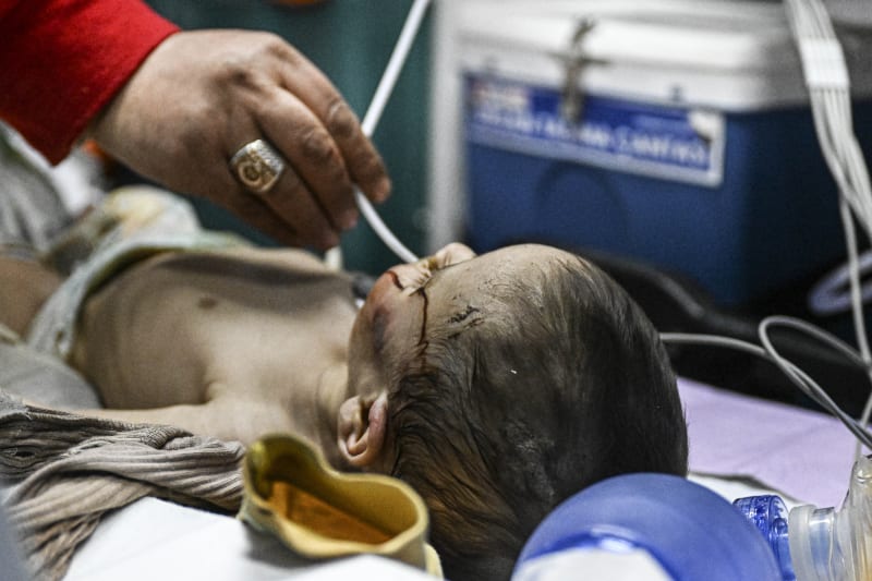 Sedmiměsíčnímu dítěti se dostává lékařské pomoci v sanitce poté, co bylo zachráněno ze sutin. (11.2.2023)