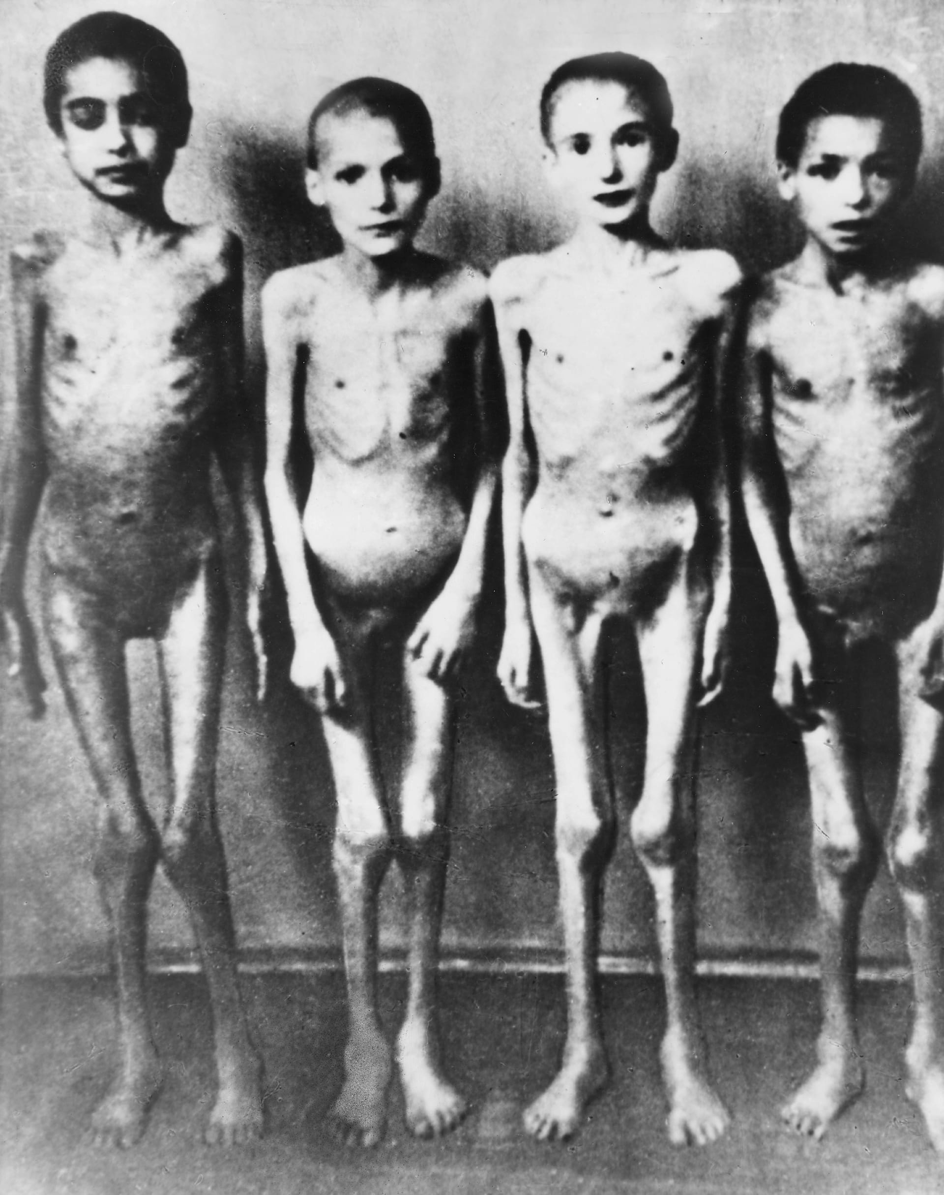 Dětské oběti Mengeleho experimentů