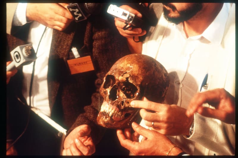 Domnělá lebka Josefa Mengeleho