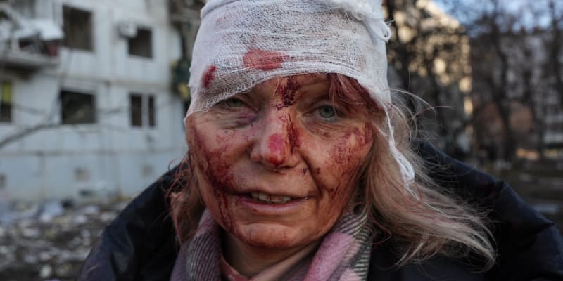 Fotografie zraněné Oleny z Charkova v první den ruské invaze oblétla svět. (24. 2. 2022)