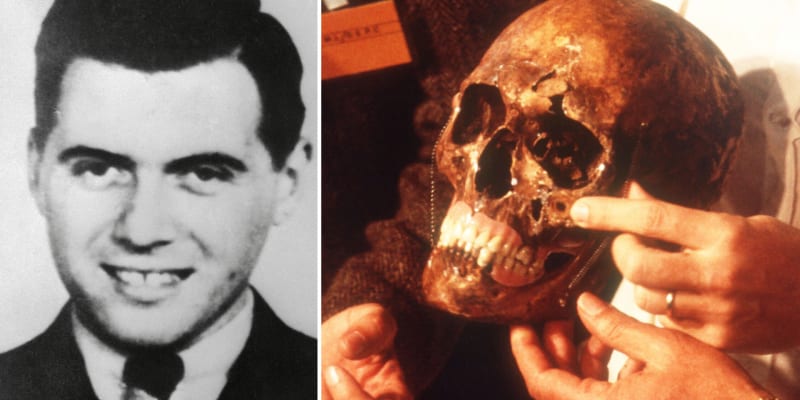 Mengele a jeho lebka