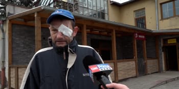Rozbitá hlava a přelepené oko. Muž ze Sokolovska popsal hrůzný útok v hospodě