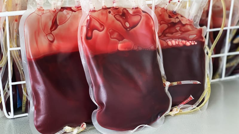 Doktoři do lidí pumpovali mléko místo krve. Bizarní transfuze zachraňovala životy