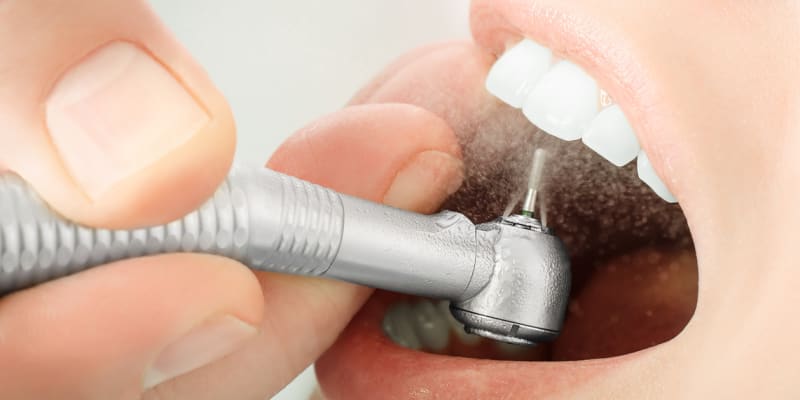 Zubní sklovina je velmi odolná, ale bohužel ne nezničitelná