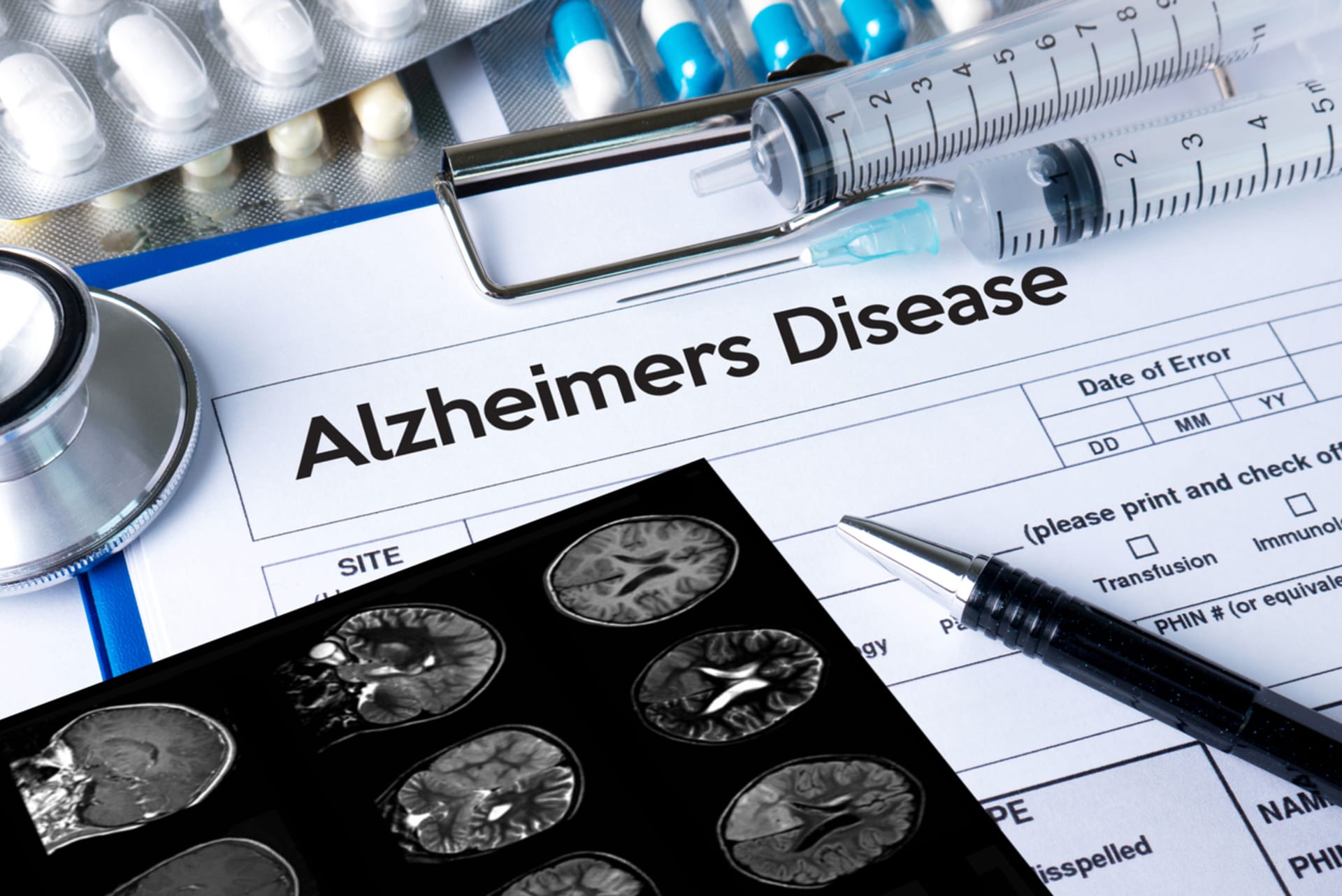 Nález na mladíkově mozku odpovídá Alzheimerově chorobě