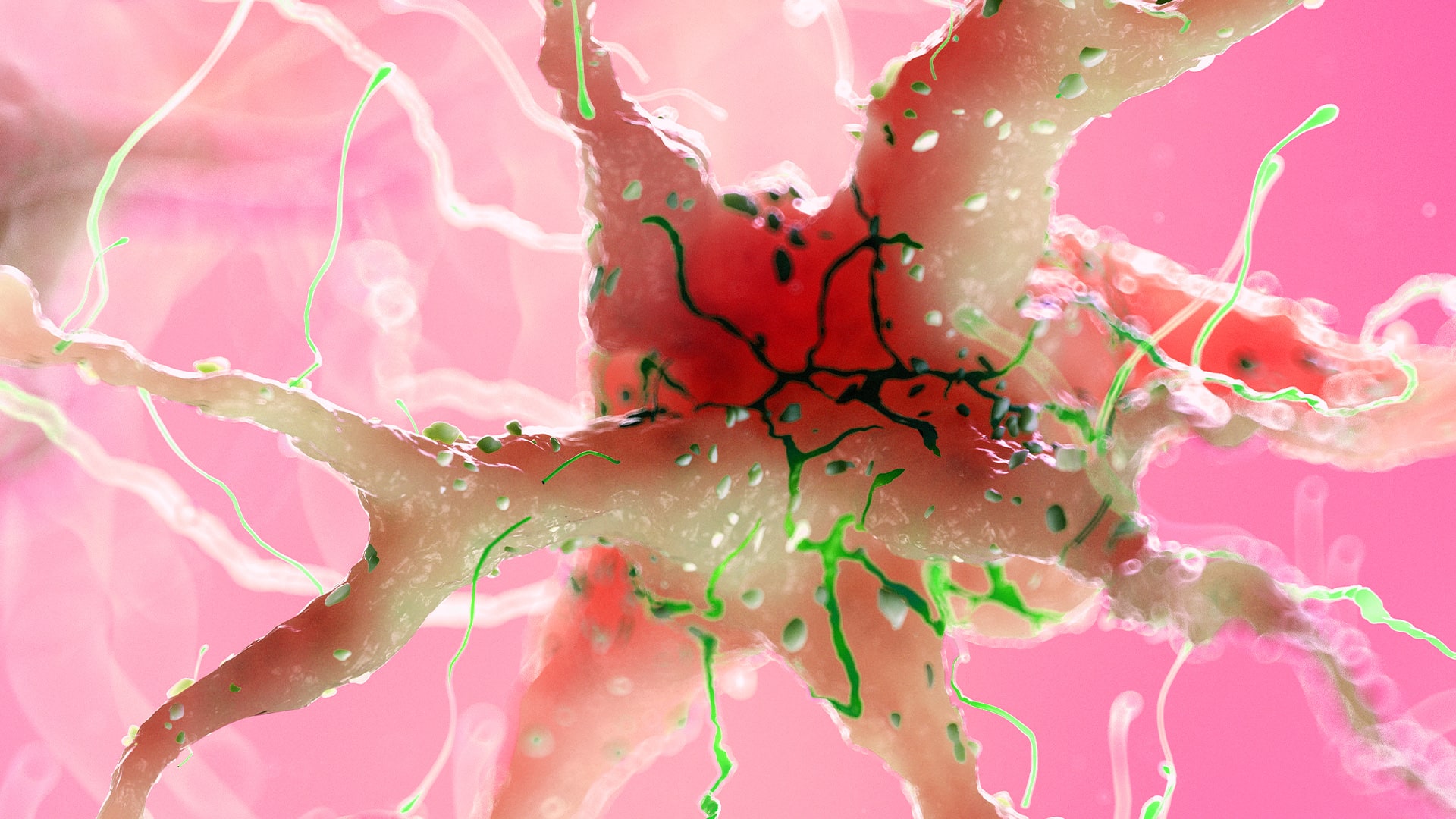 Poškozená nervová buňka (ilustrační foto)
