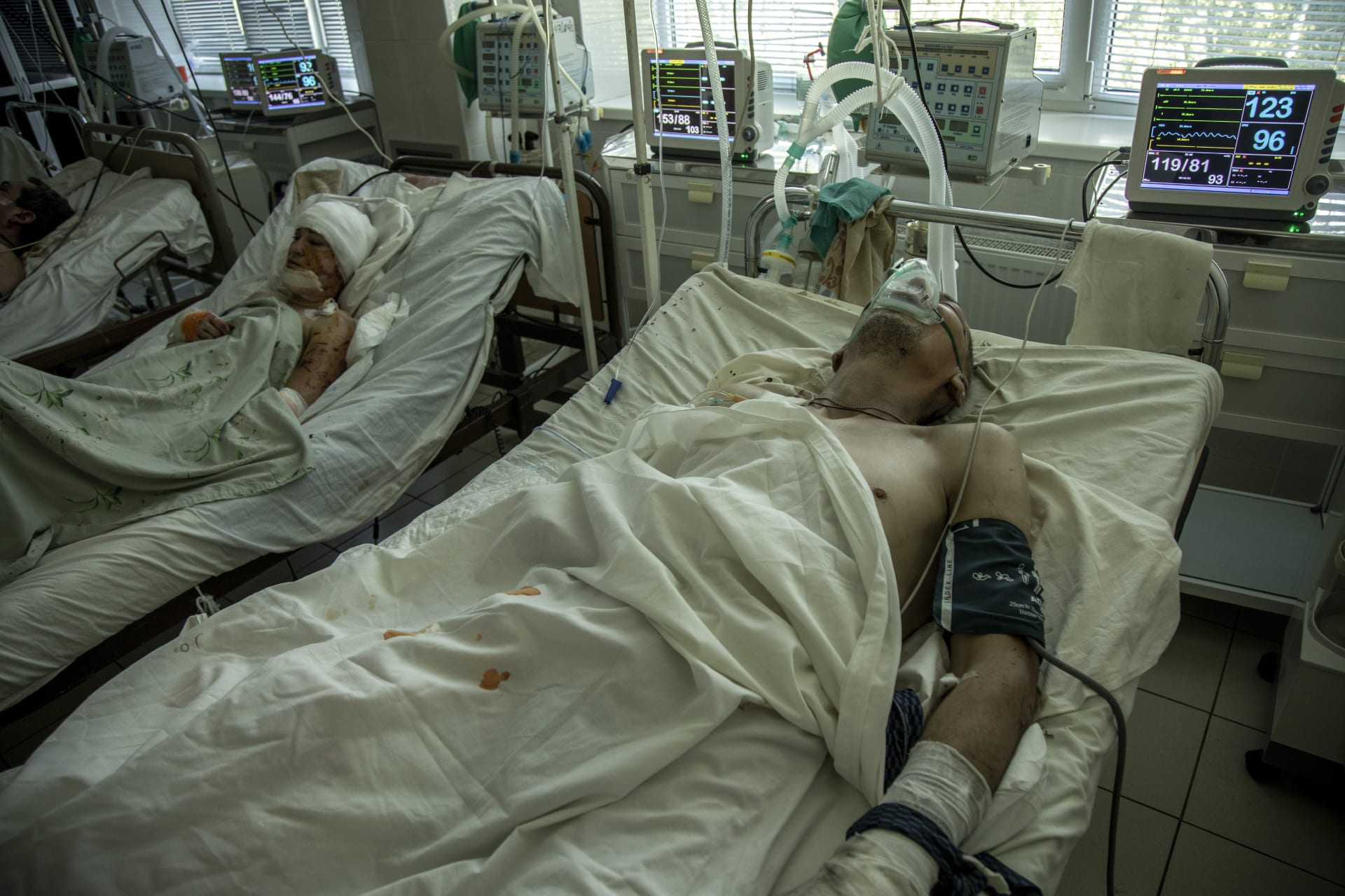 Místní obyvatelé se zotavují ze svých zranění na jednotce intenzivní péče v ukrajinské nemocnici (ilustrační foto).