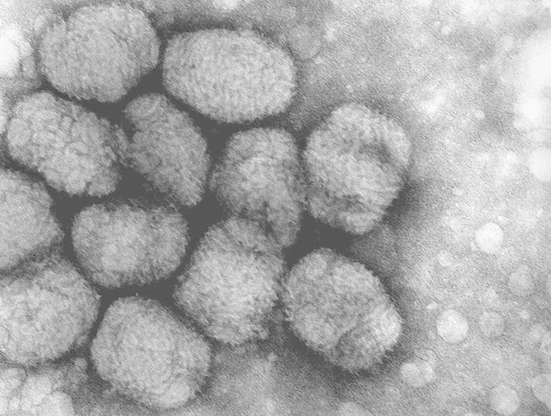 Virus neštovic