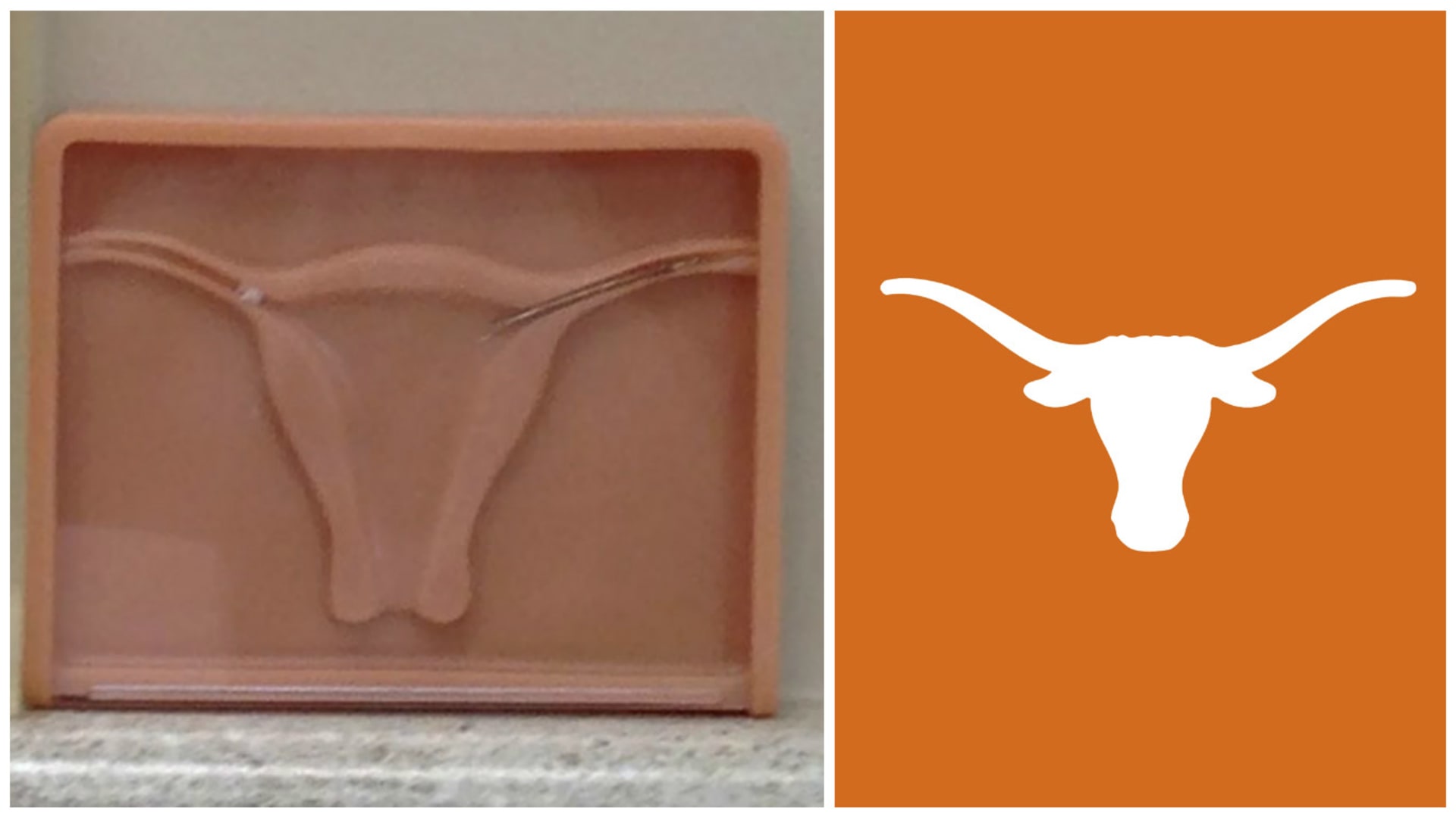 Manžel se zeptal jejího gynekologa, proč má v čekárně ten znak Texas Longhorns, jestli je taky fanoušek