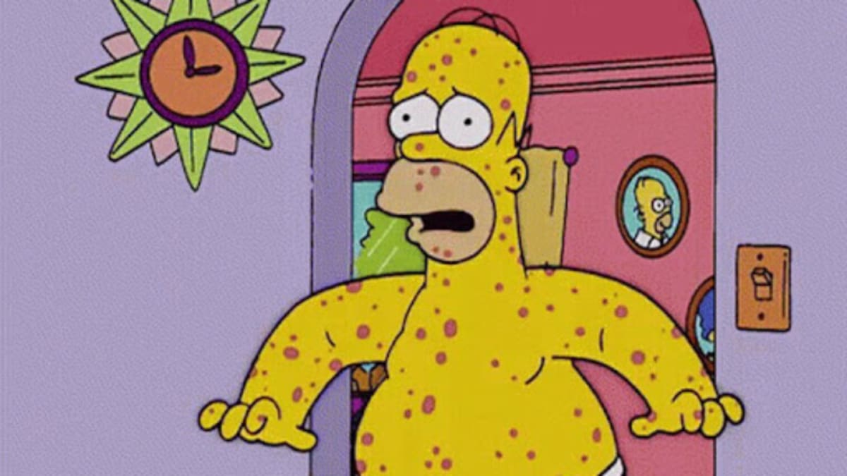 Homer Simpson nakažený neštovicemi