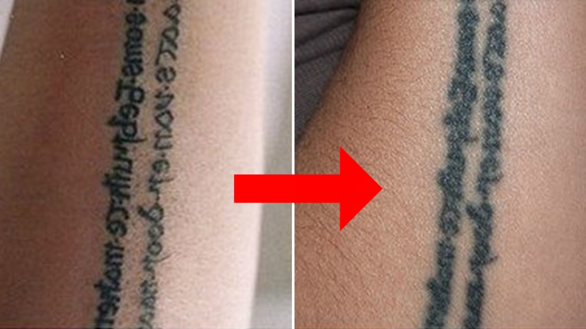 Tetování bledne a rozpíjí se