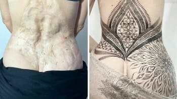 Tetování, co proměnila jizvy a mateřská znaménka v umění