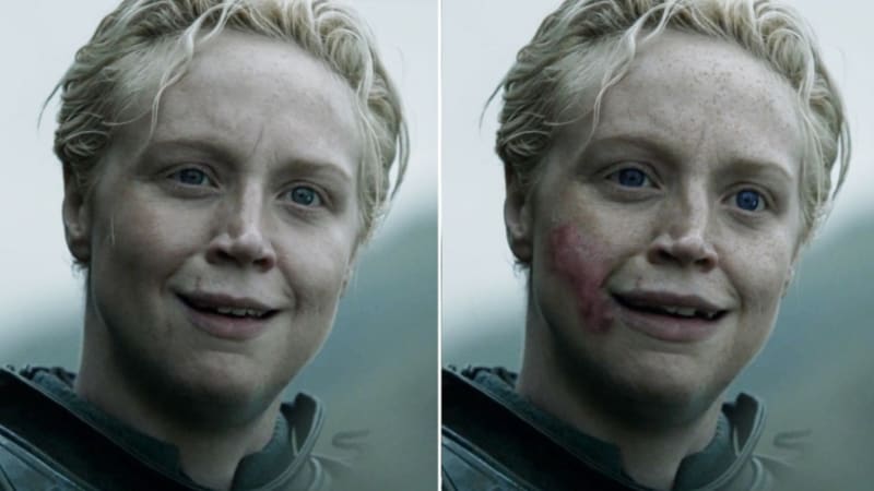 Pokud bylo na Brienne něco hezké, pak to byly její výrazné modré oči, disponovala však křivými zuby, ohnutým nosem a jizvami na tváři...