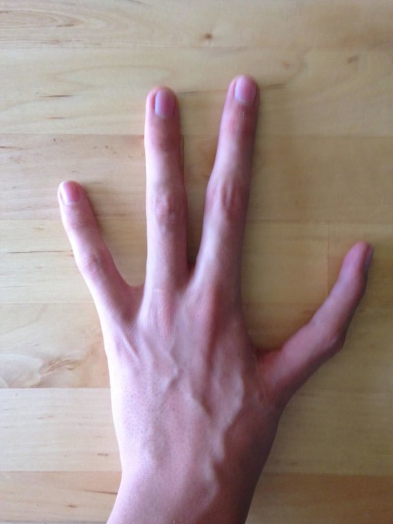 Na levé ruce má pouze čtyři prsty a místo palce ukazovák