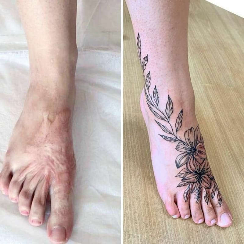 Tetování, co proměnila jizvy a mateřská znaménka v umění 14