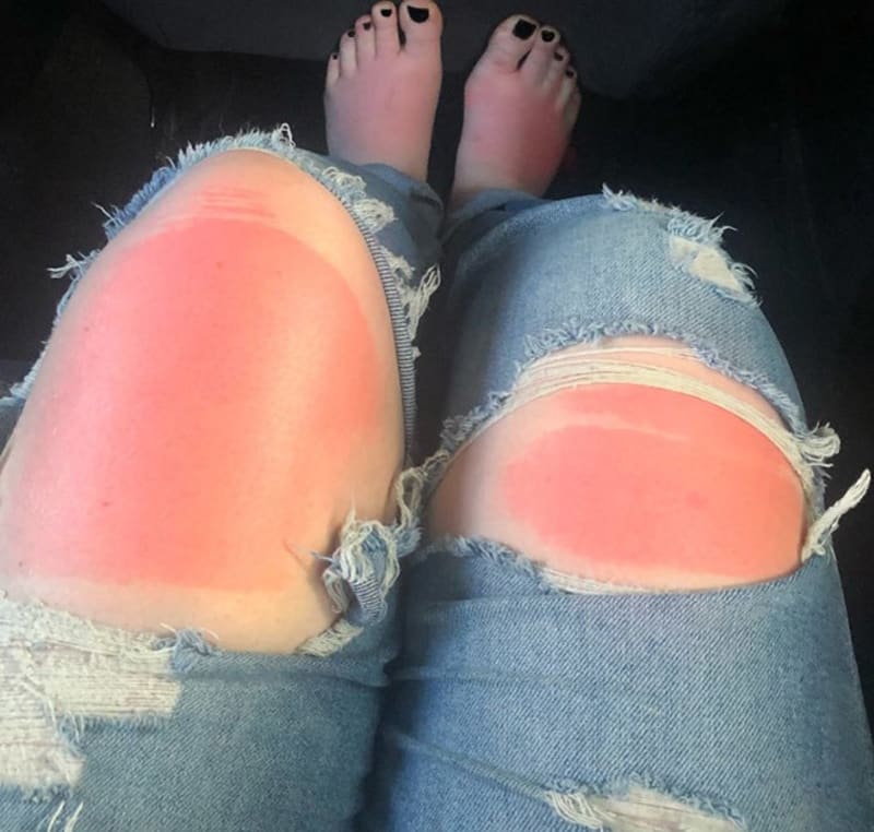 Děravé kalhoty VS. letní slunce 11
