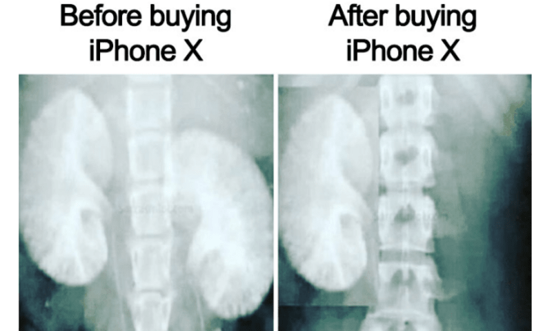 Před a po nákupu nového iPhonu X