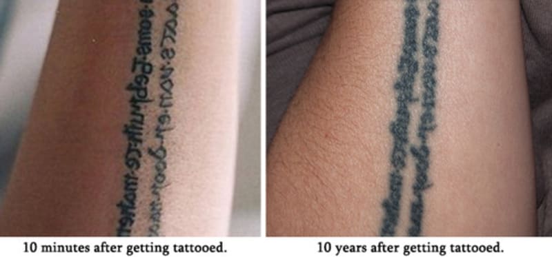 Jak vypadá staré tetování? 10