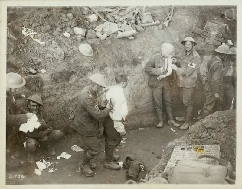 Voják v šoku z výbuchu granátu kouká "do ztracena"... (1916)