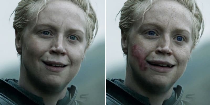 Pokud bylo na Brienne něco hezké, pak to byly její výrazné modré oči, disponovala však křivými zuby, ohnutým nosem a jizvami na tváři...