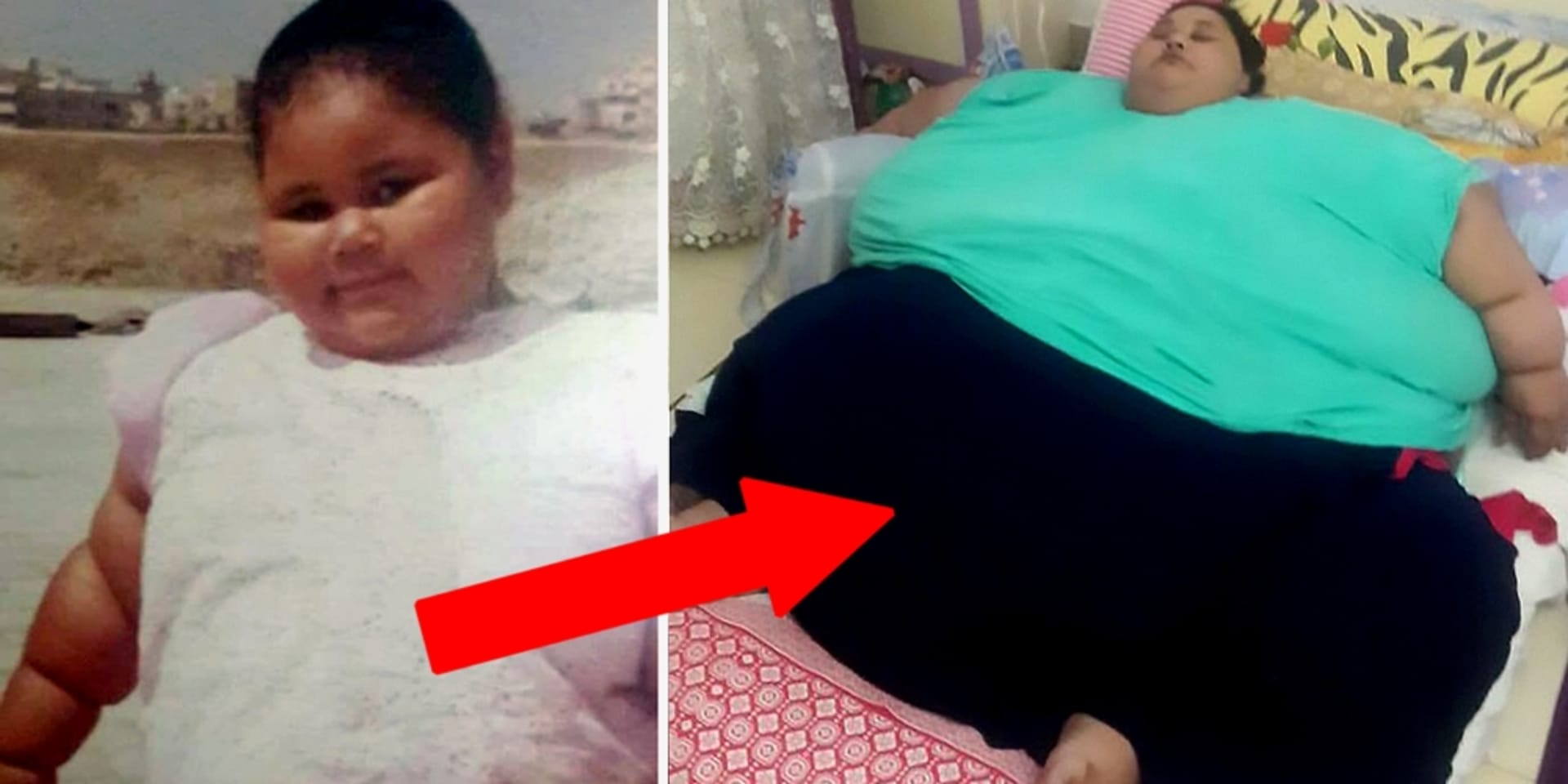 Nejtlustší žena světa váží 500 kilo