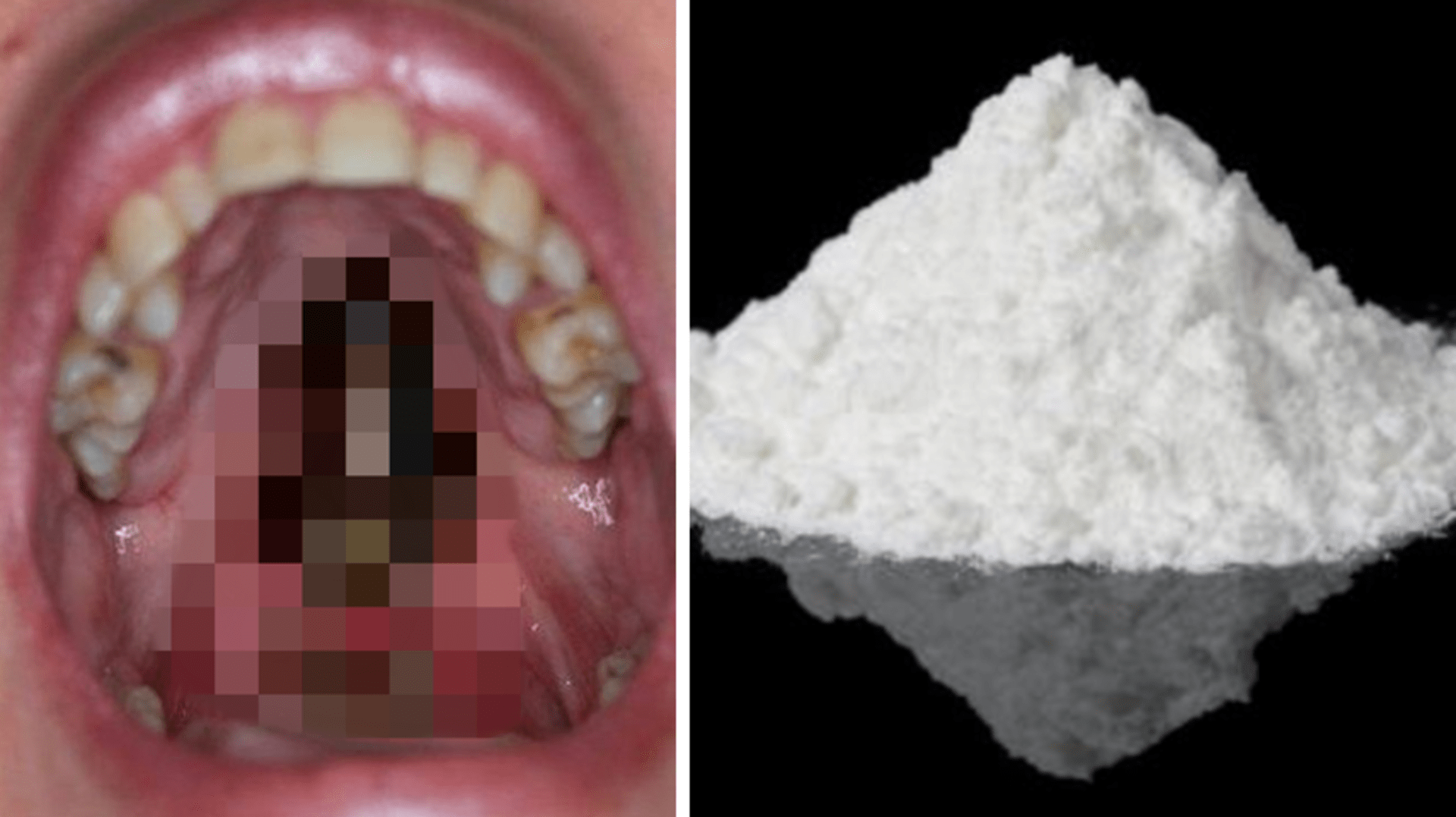 Co s vaším krkem udělá kokain?