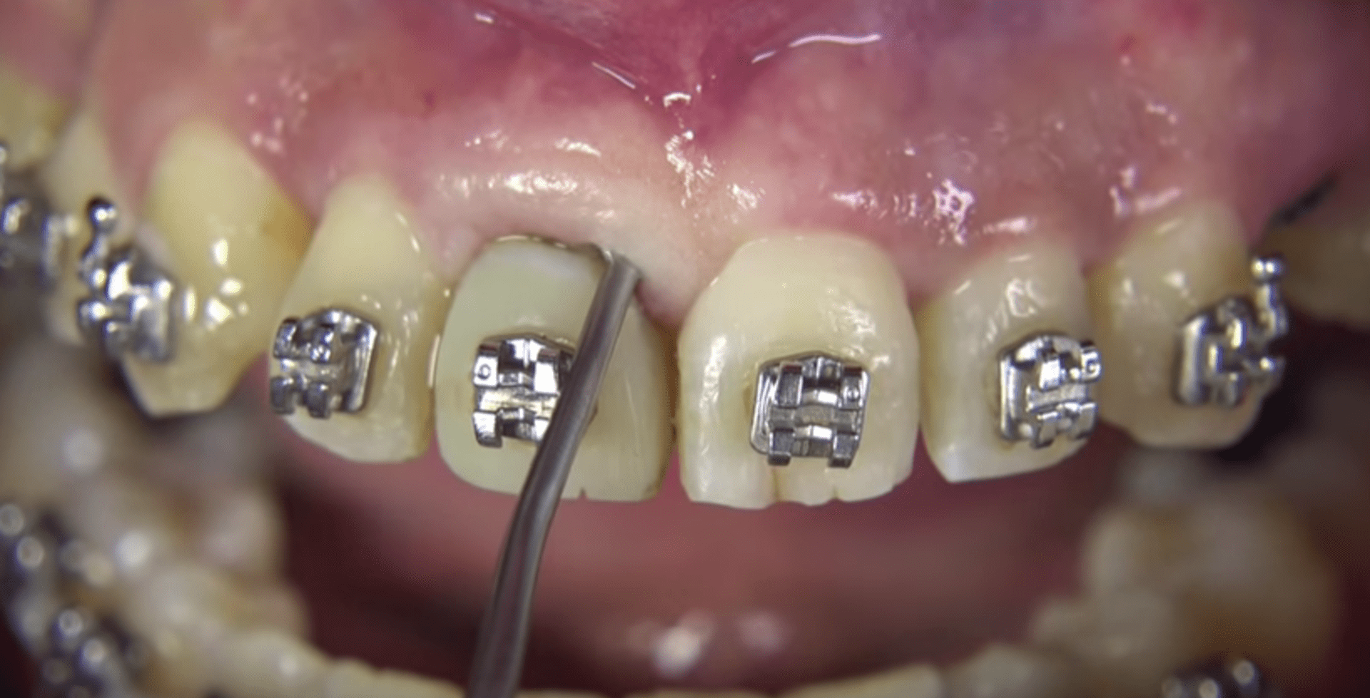 Takhle to vypadá u zubaře...