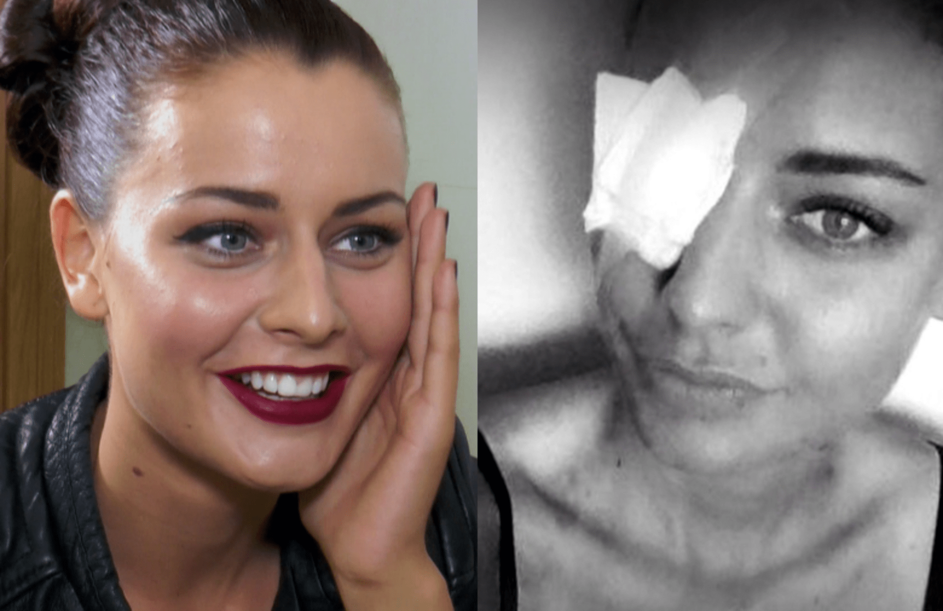 Modelka Chlebovská podstoupila bolestivou operaci oka. Co se jí stalo?