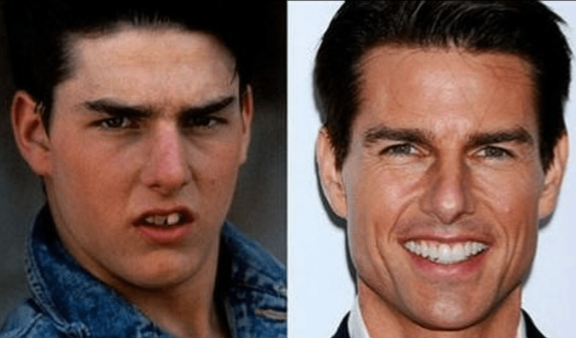 Video VIP zprávy: Tom Cruise měl v mládí pěkně křivý úsměv...