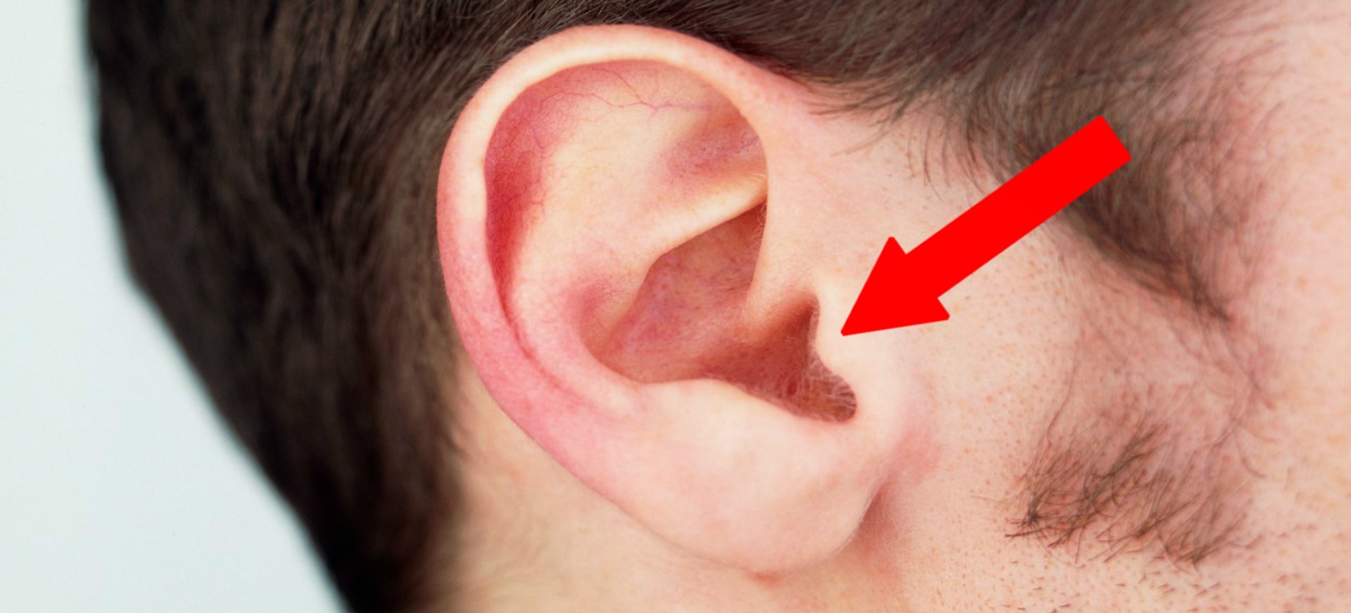 Co znamená tato vráska na uchu?
