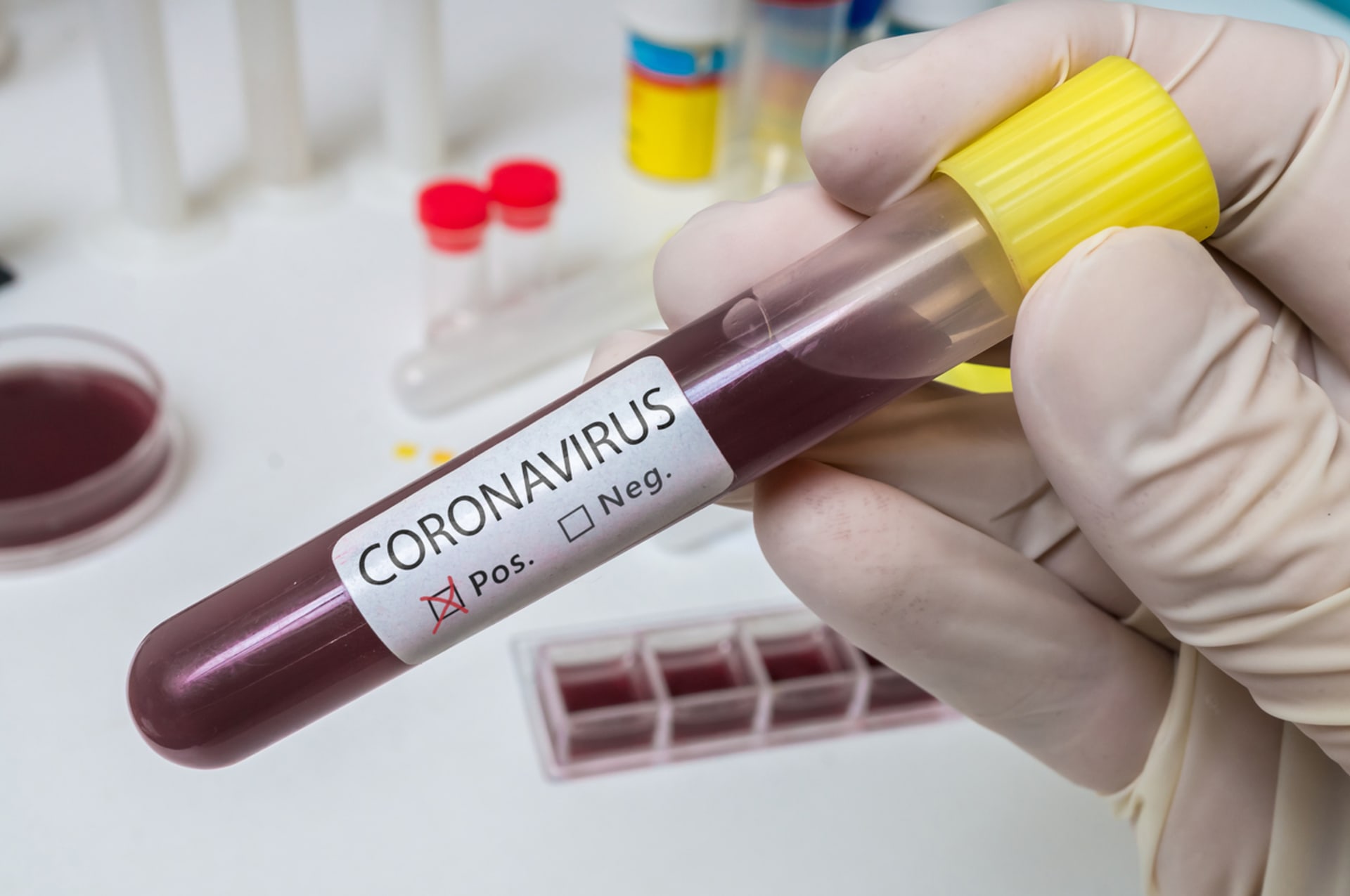 Koronavirus jako práce? 1