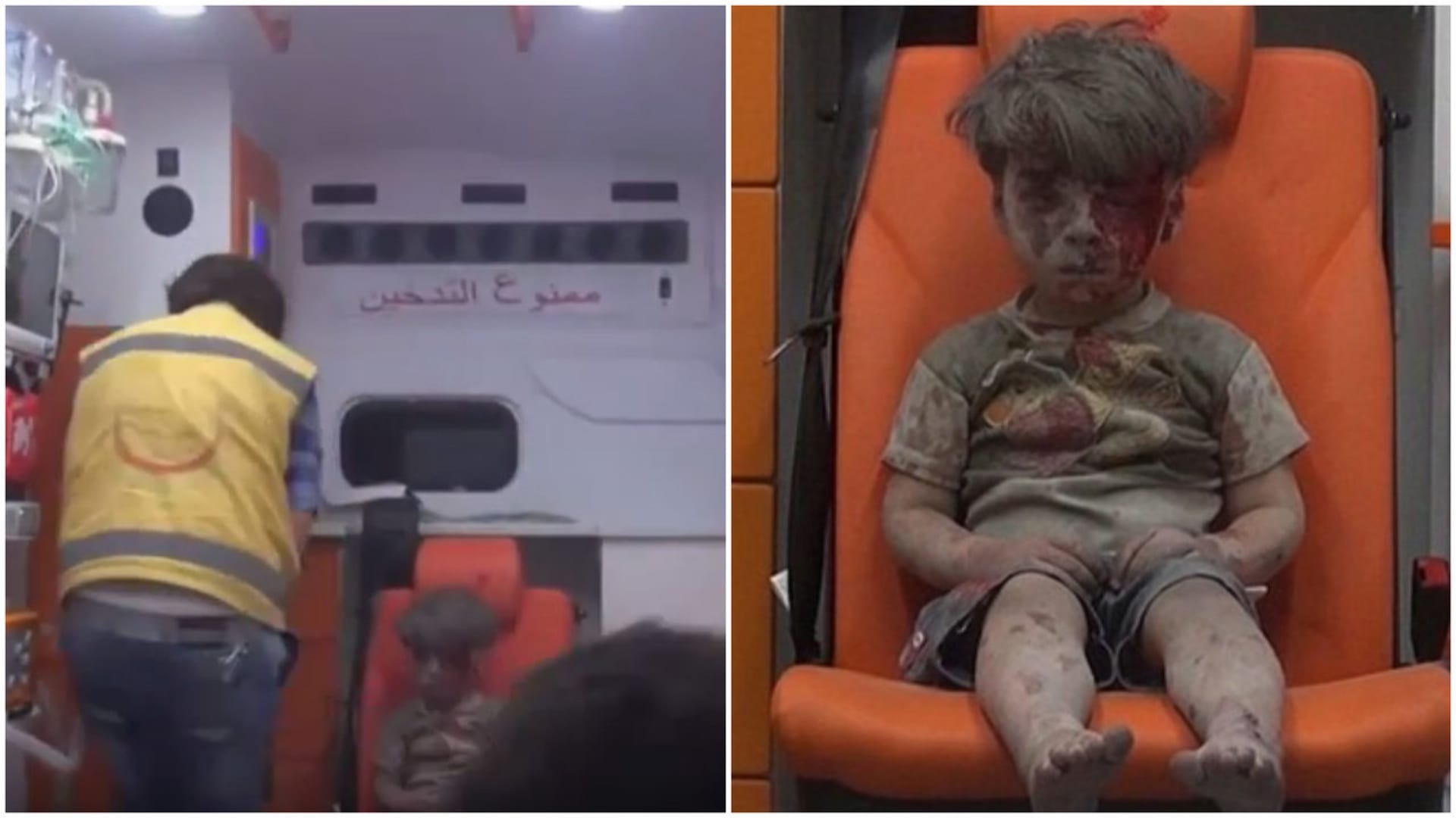 Malý chlapec po útoku v Sýrii