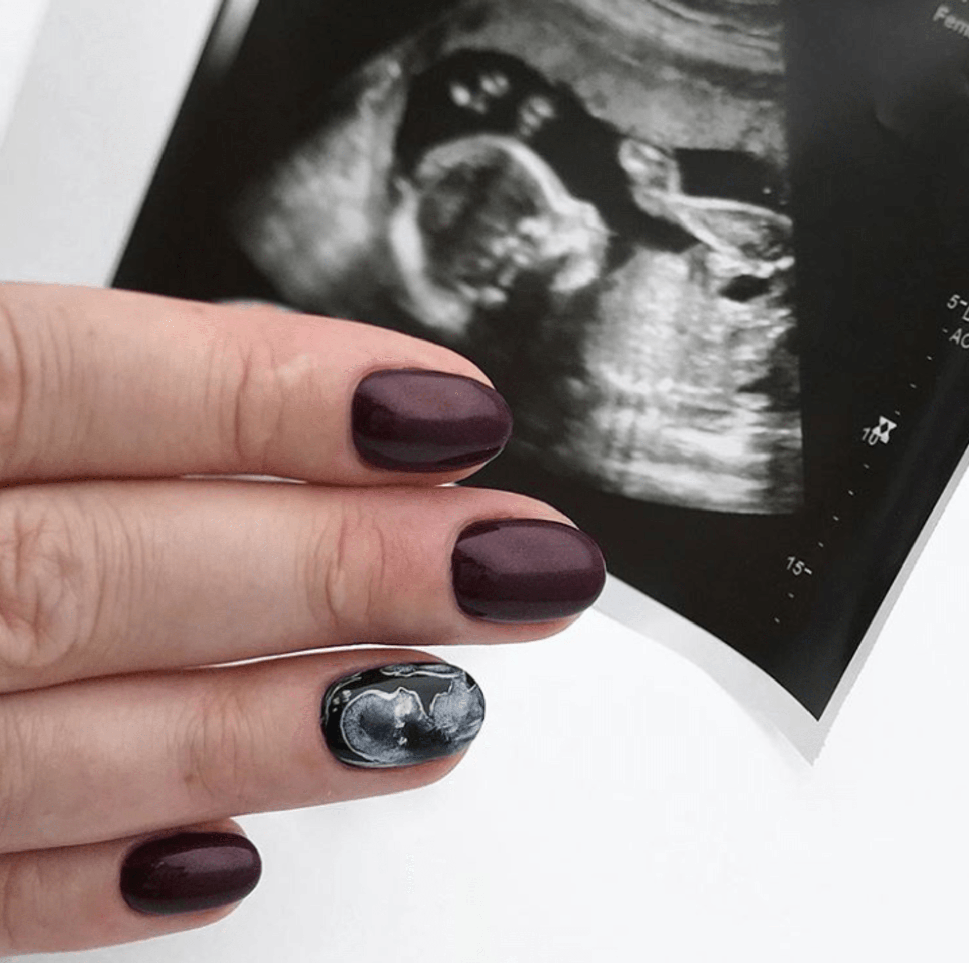Ženy si nechávají na nehty malovat své snímky z ultrazvuku 1