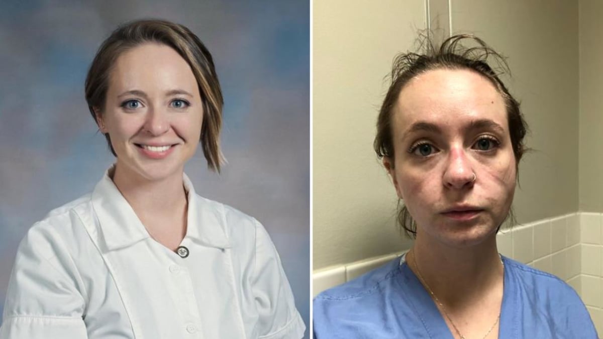 Zdravotní sestra sdílela fotky před a po koronaviru.
