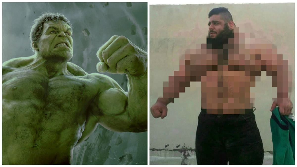 Muž vypadá jako Hulk!