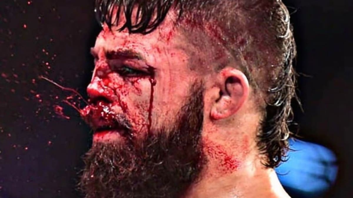 Brutální zranění nosu při zápase UFC 2