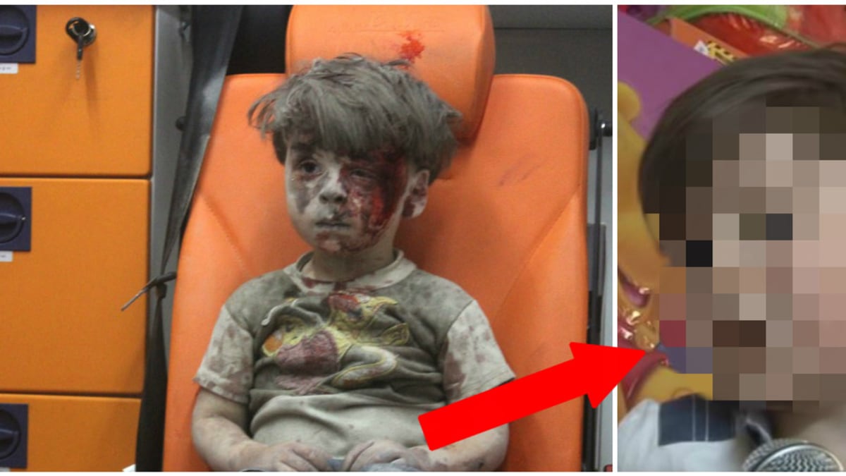 Jak vypadá Omran Daqneesh rok od bombardování Aleppa?