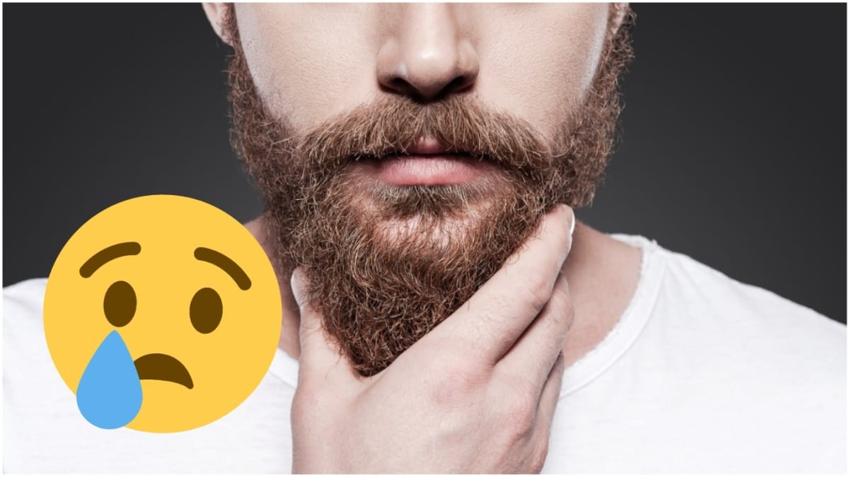 Proč některým mužům nerostou vousy? 1