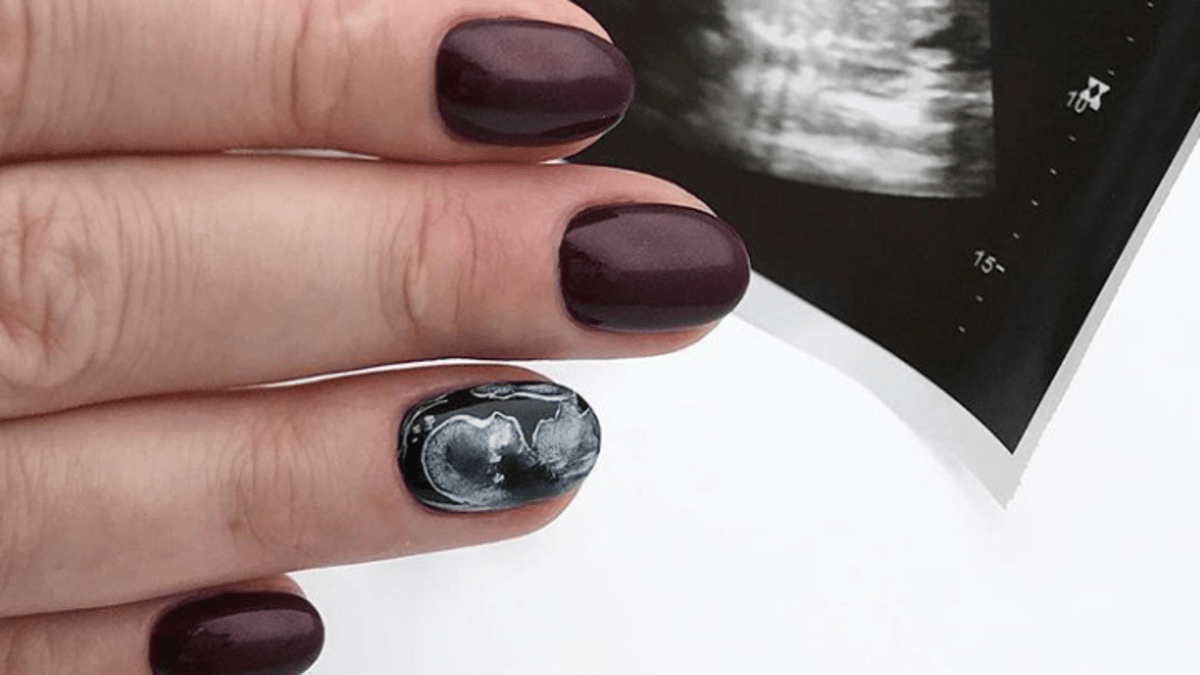 Ženy si nechávají na nehty malovat své snímky z ultrazvuku 1