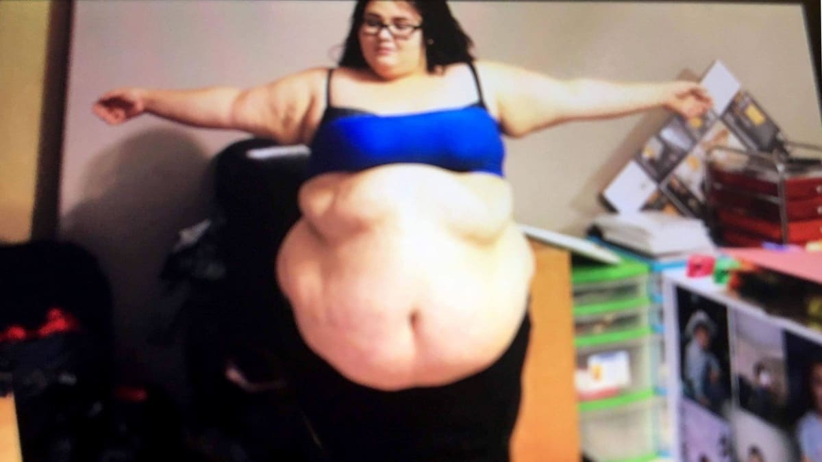 Žena zhubla neuvěřitelných 82 kilo 3