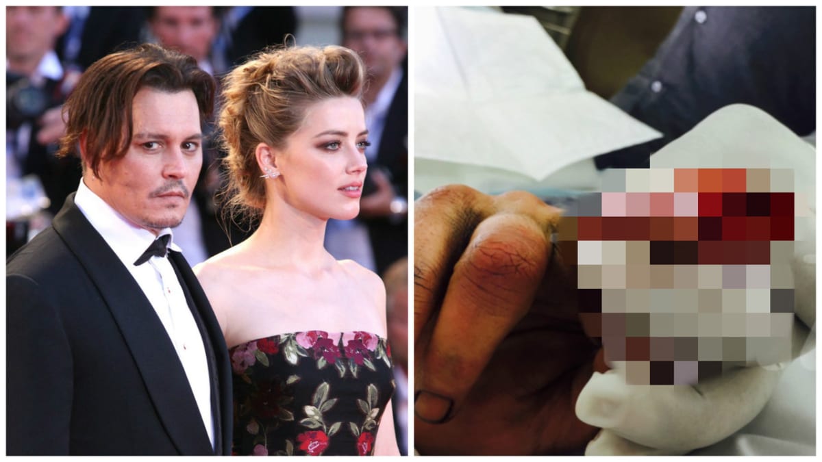 Opravdu si Johnny Depp uřízl prst?