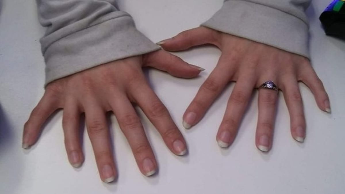 Přišla zákaznice a nechala mě vyfotit si její ruce, které měly šest prstů.