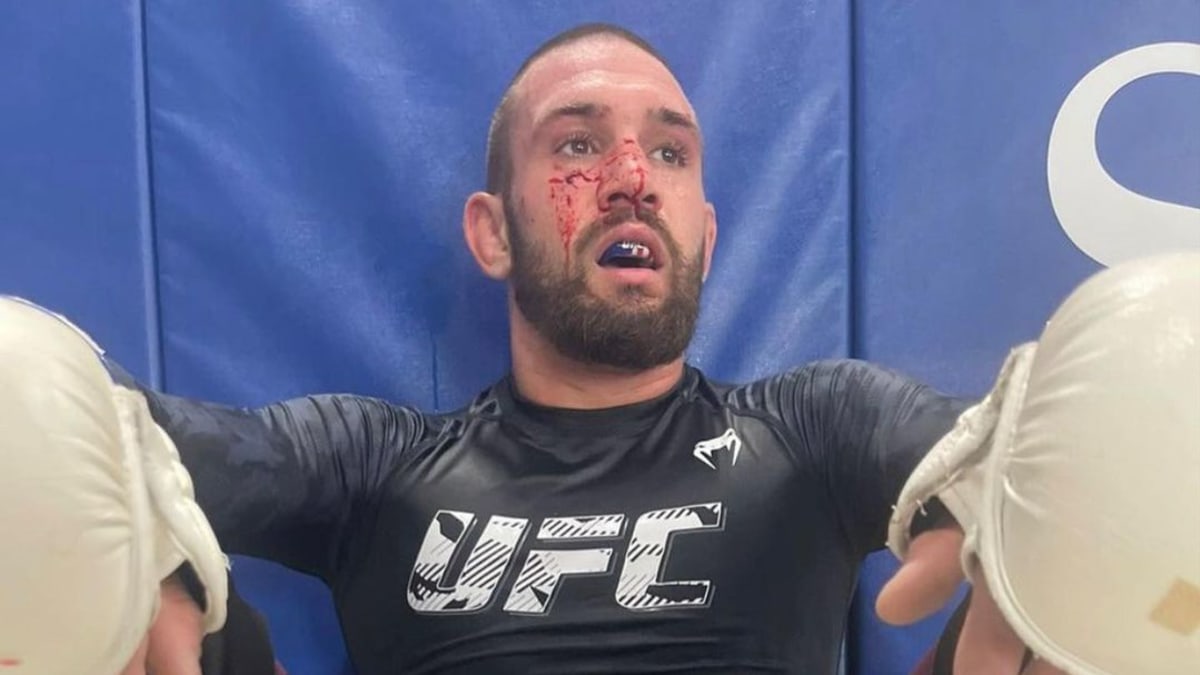 Slavný UFC zápasník si bizarně zranil ruku 1